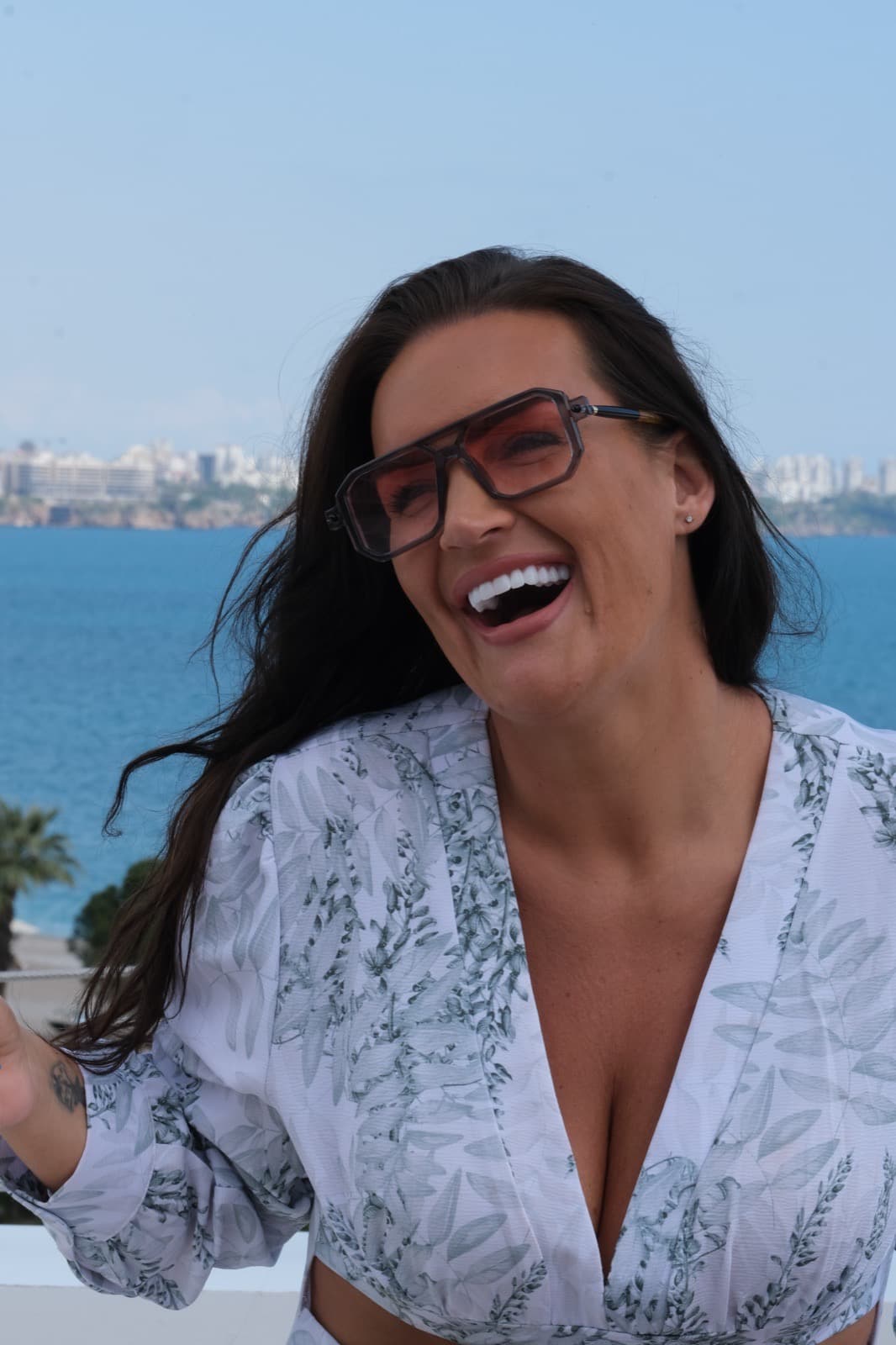 What is a Hollywood Smile?