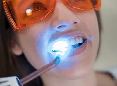 Laser Dentistry: What It Treats and Why It Hurts Less