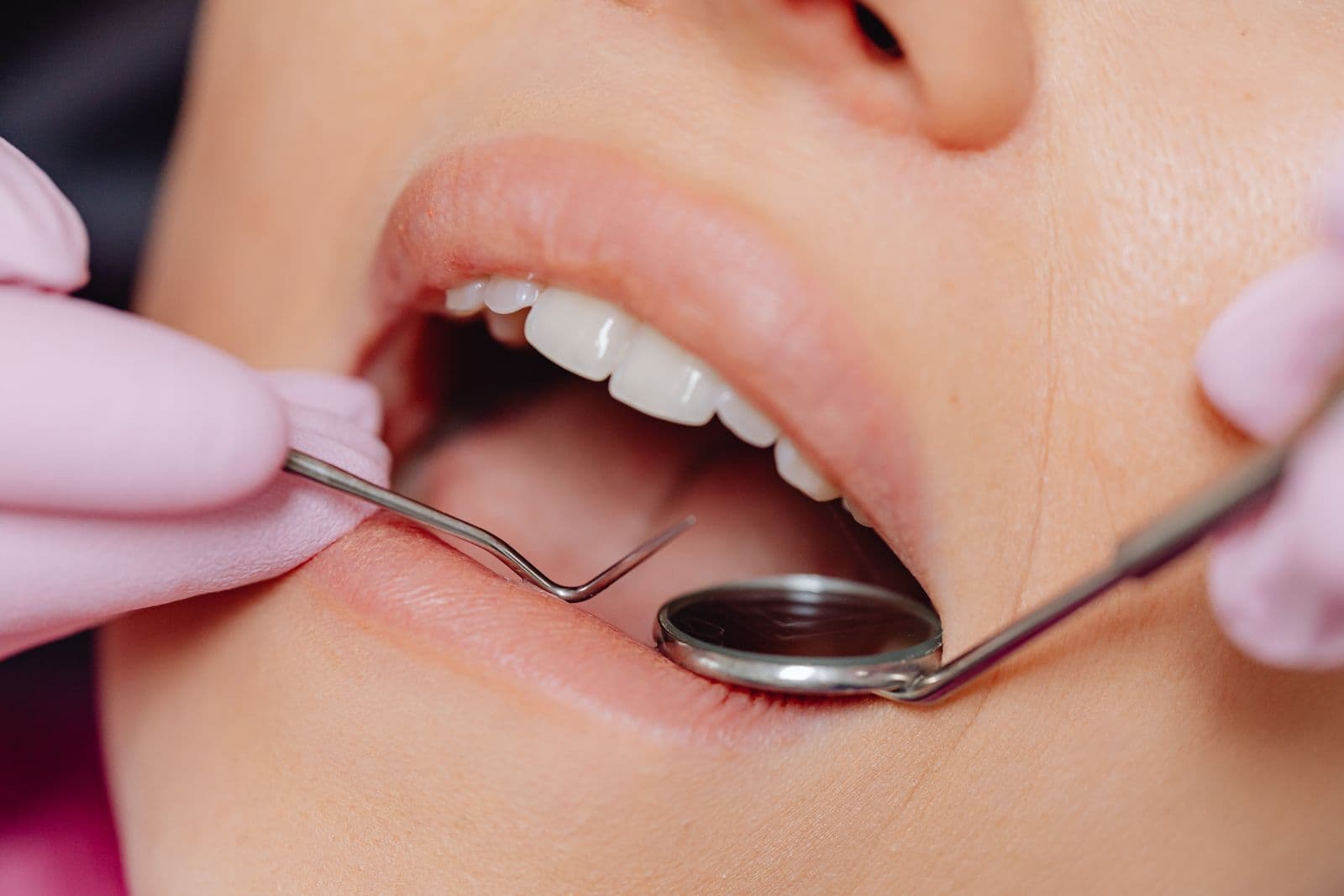 Understanding gum disease and its impact on your dental health